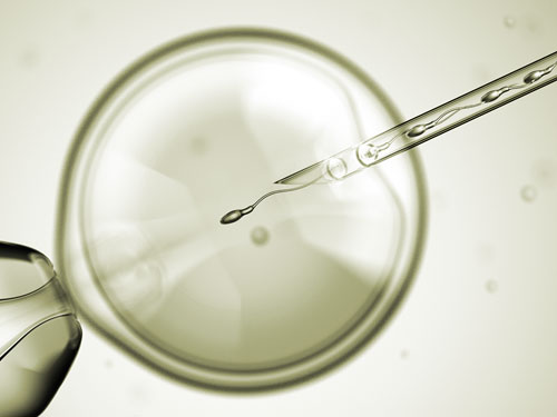 IVF - ICSI