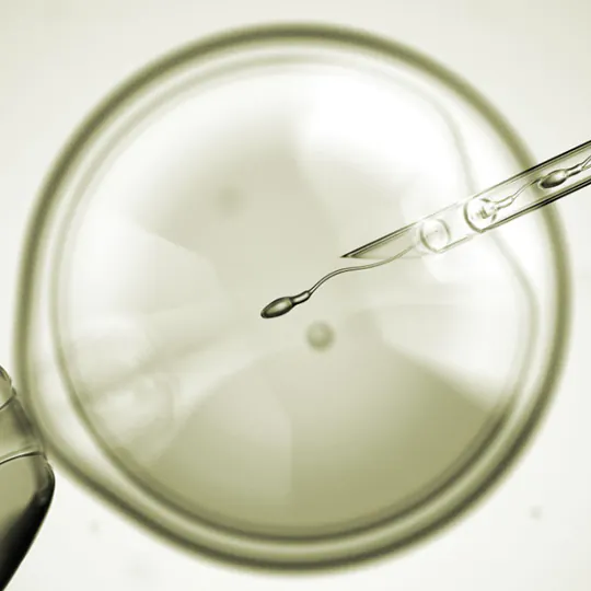IVF/ICSI