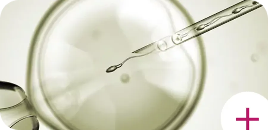 IVF / ICSI