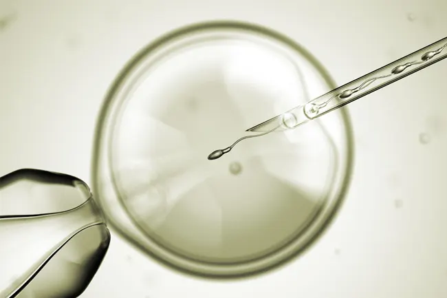 ivf icsi kuenstliche befruchtung